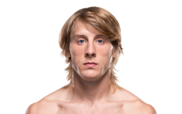 Paddy Pimblett